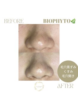 ネス 沖縄店(Nes.)/BIOPHYTO/ビオフィート