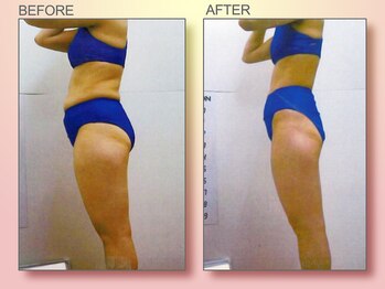 ジュリア オージェ 京橋店/ビフォーアフター(脂肪燃焼)