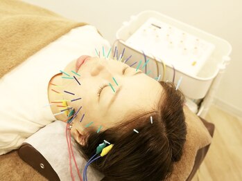 ウル鍼灸整骨院/美容鍼♪