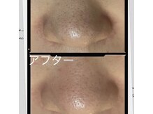 フルール(fleur)の雰囲気（【美容液で洗う毛穴洗浄】本気の毛穴ケアをしませんか？）