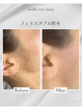 ジョエルワックス 沖縄コザ店(JOELLE WAX)/フェイスワックス脱毛