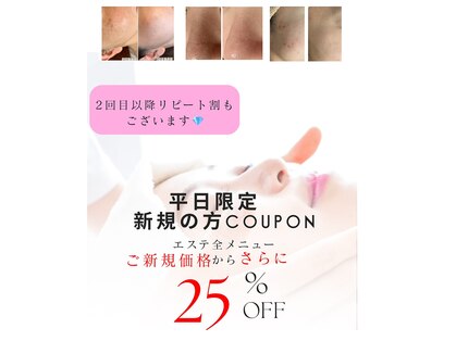 ラウレア(Laule’a)の写真