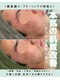 グリーンピール エルモナ(GREENPEEL ELMONA)の写真/「他のハーブピーリングでは満足できなかった」「ニキビ・毛穴・赤みが改善しない」そんなお悩みに。