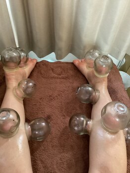 りゅう中国整体院 自由が丘の写真/足裏カッピングむくみ冷え解消　30分　4,300円