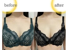 ラジュワード(lajward)の雰囲気（４ヶ月のバストの変化◎セルフケアも取り組んでいただいています）
