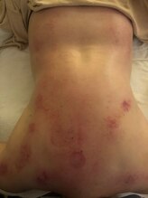 中国整体 らくらく堂/温熱療法デトックスこり解消