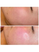 ヒメミ(Himemi)/艶肌Ｗａｘ