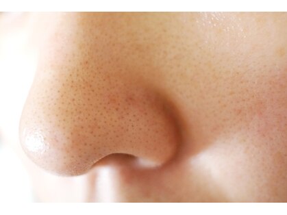 メナードフェイシャルサロン カノンドピュア 江別の写真