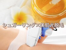 エピナス 町田店(epinus)の雰囲気(シュガーリング&光脱毛のダブル脱毛ならエピナス町田店へ★)