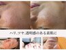 ゲリラ価格後２名！【透明感&ツヤ肌】毛穴洗浄×光フェイシャル×パック