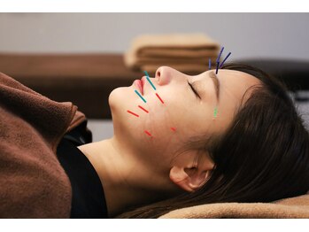 小林整骨院 高井戸/オーダーメイド美容鍼