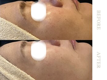 ソワ 恵比寿(soi)/ENVIRONエンビロンBASICコース