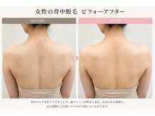 飛花(HIKA)/背中美人目指すなら飛花へ♪