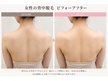 飛花(HIKA)/背中美人目指すなら飛花へ♪