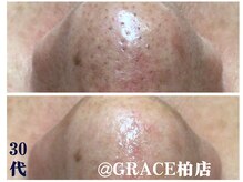 グレース 柏店(GRACE BEAUTY SALON)