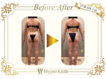 スキニー 六本木店(Skinnie)/筋肉質なお体もこの通り！