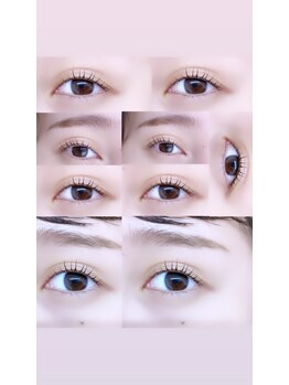 ビラ ベルダ(Bira Beldad)/