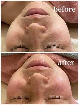 シャインクラフト/