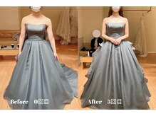 ルフレ(REFLET)/【事例14】Before/After痩身