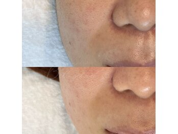 ベルアイラッシュ(Belleyelash)/【フェイシャルワックス】