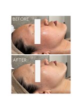 サンジュウロクドゴブ(36.5℃)/リアボーテハーブトリートメント