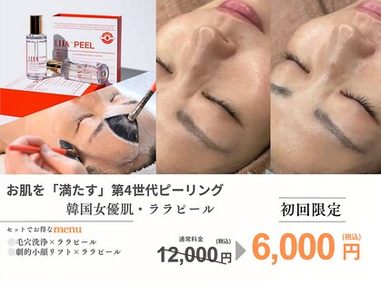 エスポワール(espoir)の写真