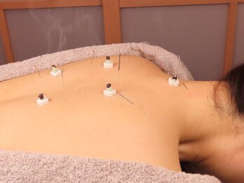 トトノウ(totonou)/個室美容鍼灸サロンtotonou