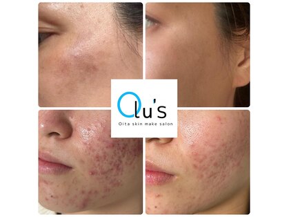 オルズ(Olu's)の写真