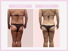 アコガレコガオ 秋田店/