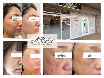 アルルプラス 南草津(ARuru+)の写真