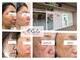 アルルプラス 南草津(ARuru+)の写真