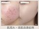 リトルーム(Litroom: from Seoul)の写真/敏感で弱ったお肌が改善!!韓国最先端技術で乾燥やかゆみや赤みも解消◎肌荒れケアして素肌自慢のお肌へ
