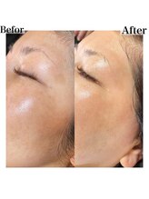 プリュスマイル(+Smile.)/フェイシャルワックス