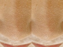 【極上たまご肌】浮き出る韓国式3D毛穴洗浄