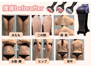 ジュリス(JURIS)/キャビリポプロ