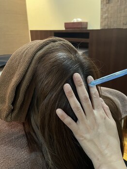 スイ スーパースカルプ松阪店(SUI)/頭皮毛穴クレンジング