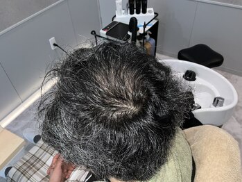 トウキ(TOUKI)/強髪プログラム