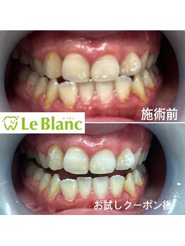 ルブラン 奈良店(Le Blanc)/食事制限無し!