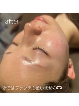スピカ(Spica)/☆今はファンデも使いません(^^)