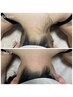 宮崎希少ツル肌【うなじワックス脱毛】