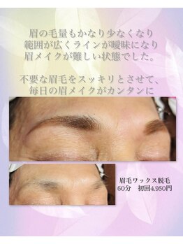 ソルティ 寺田町(Salty)/大人の眉毛ワックス脱毛