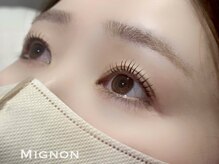ミニョン(Mignon)