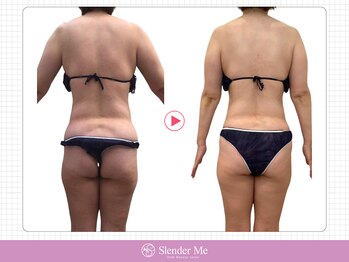 スレンダーミー 甲府本店(Slender Me)/ダイエット実績