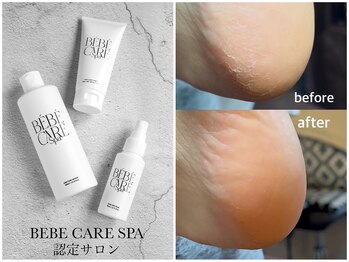 モーブ(mauve)/べべケアスパ