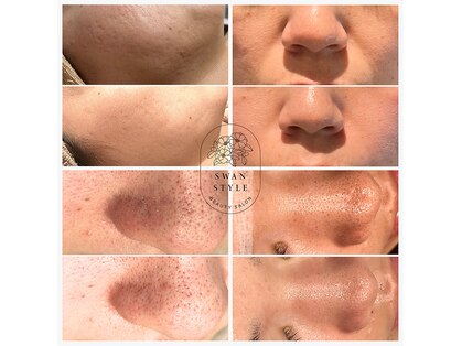 スワンスタイル(SWANSTYLE)の写真