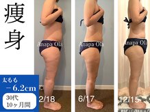 アナパ・オラ/マグニート×6種痩身マシン