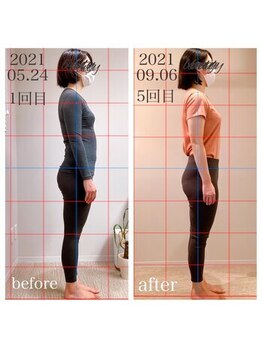 あんず美容整体サロン/◆姿勢症例◆