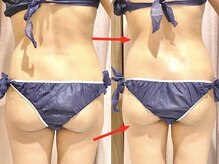 ソフィア(SOPHIA)の雰囲気(人気No1痩身【セルゼロ2】は1回でもくびれや凸凹肌にすごい☆)