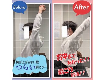 ナオル整体 西川口院(NAORU整体)/バンザイのチェック♪　柔軟性up