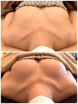 美人バスト 札幌店/バストアップ×育乳◇症例◇